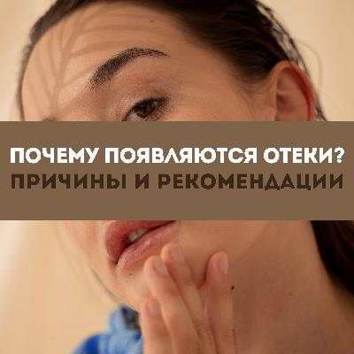 Почему появляются отеки? Причины и рекомендации.