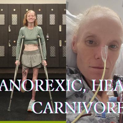 Surviving Anorexia & Amputation With Carnivore
