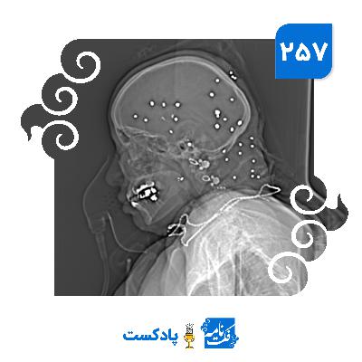 شلیک به سر و صورت شلیک به سر و صورت