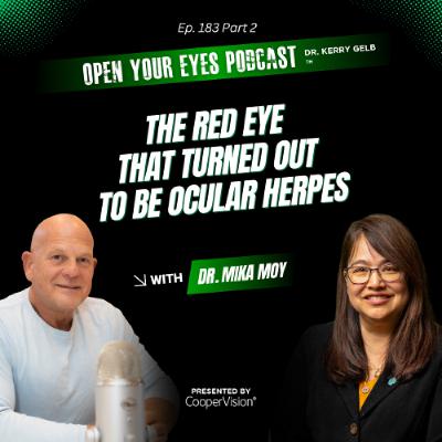 Ep. 183 Part 2 "The Red Eye That Turned Out to Be Ocular Herpes" - Dr. Mika Moy