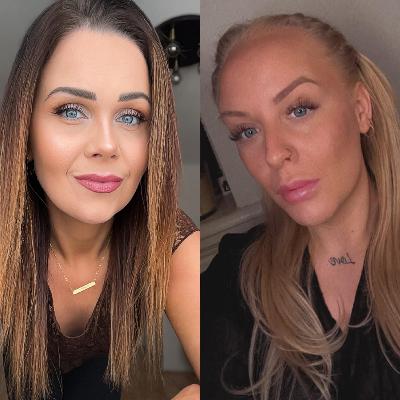 Eldgosið við Grindavík. Eldgosið við Grindavík.