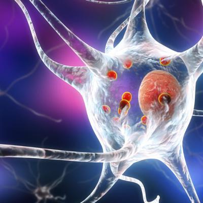 Enfermedad de Párkinson