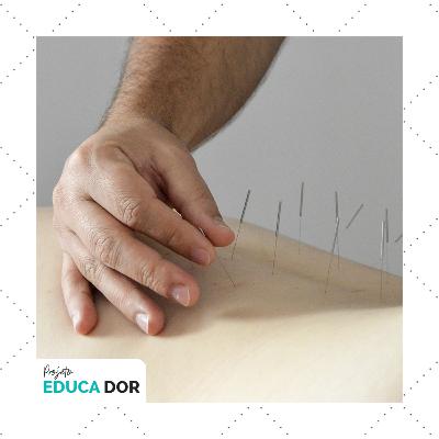 #48 - Acupuntura no tratamento da dor crônica