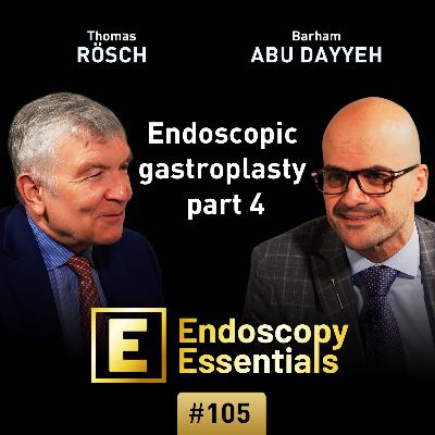 Endoscopic gastroplasty part 4: Aftercare Endoscopic gastroplasty part 4: Aftercare